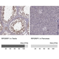 RPGRIP1 Antibody, Novus Biologicals 25ul | Buy Online | Novus Biologicals | Fisher Scientific